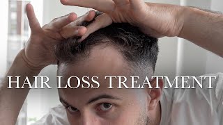 WE'RE TESTING OUT THIS HAIR LOSS TREATMENT SO THAT YOU DON'T HAVE TO. (1/4)