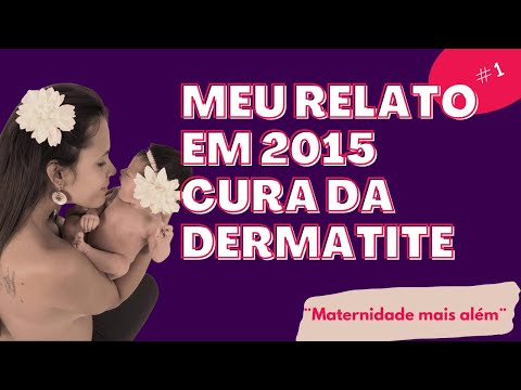 Do que tratar a dermatite atopic na criança de 5 meses Medicina de psoríase de uma forma fácil
