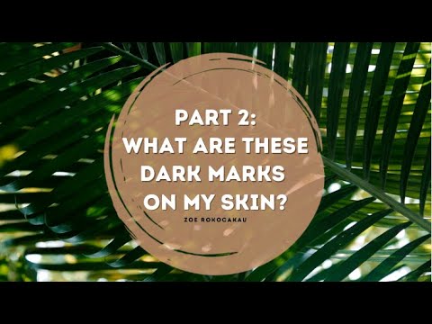Part 2: What Are These  Dark Marks On My Skin?