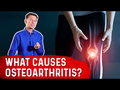 Ob die Sonne ist nützlich bei der Osteochondrose Wunder Hals und unter dem Rande