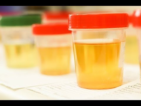 Włosy Botox w Nowosybirsku Do stylizacji włosów bujna