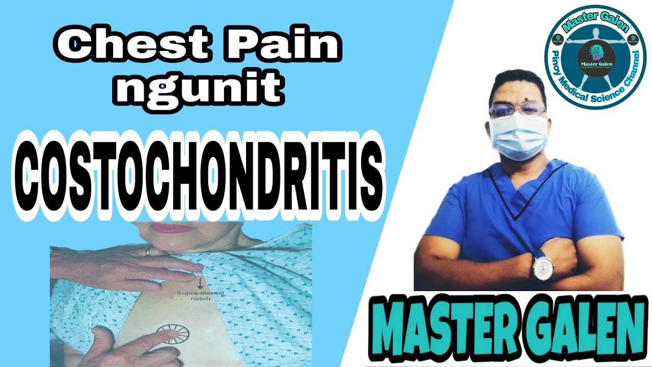 COSTOCHONDRITIS, DAHILAN NG PANANAKIT NG DIBDIB