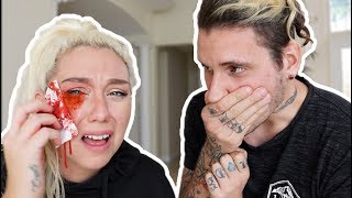 CAT SCRATCHED MY EYE PRANK! ( 911 ALMOST CALLED ) | NICOLE SKYES