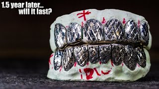 Custom Gold Grillz 1 Year Review