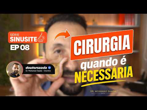 QUANDO OPERAR A SINUSITE? SINAIS DE QUE A CIRURGIA PODE SER INDICADA