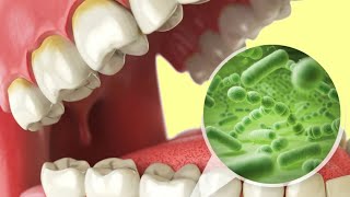 SEGREDO PARA ACABAR COM MAU HLITO