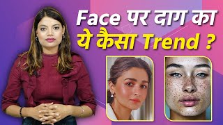 Alia Bhatt और Janhvi Kapoor  Face  Freckles  Viral, Face Freckles Trend क्या है|Boldsky*Lifestyle