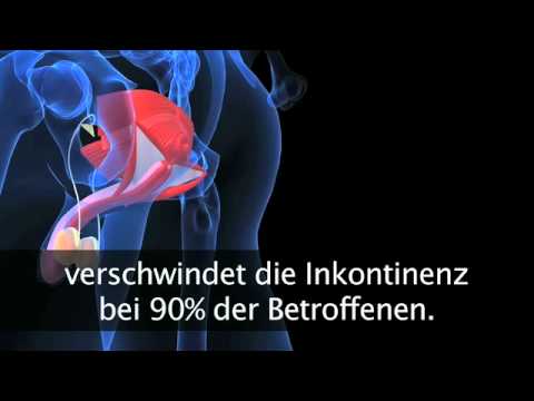 Prostatitis wirkt sich auf die Dauer des Geschlechtsverkehrs In dem Saft der roten Blutzellen der Prostata