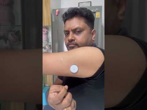 How to remove CGM. My diabetes Freestyle Libre Sensor