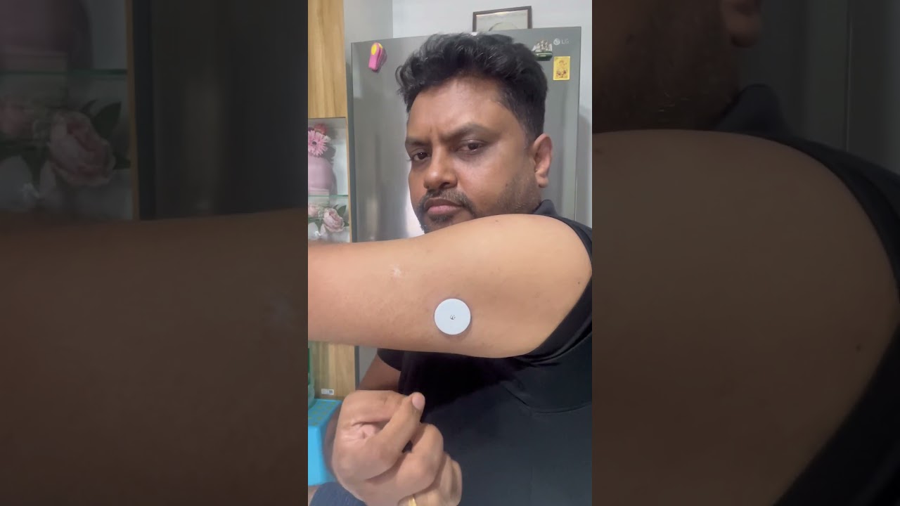 How to remove CGM. My diabetes Freestyle Libre Sensor