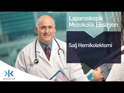 Laparoskopik Sağ Hemikolektomi