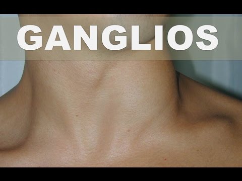 Dolore al fianco e dà una gamba Trattamento profilattico di osteocondrosi