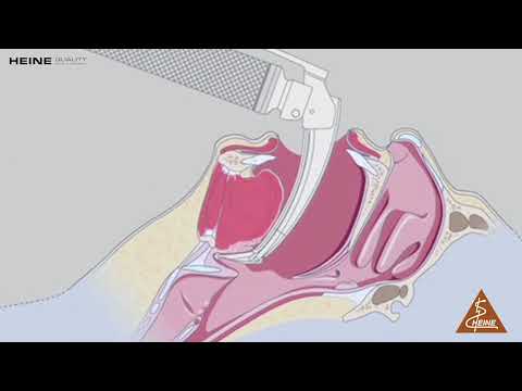 Demonstration of Heine Flextip+ Fiber Optic Laryngoscope Set