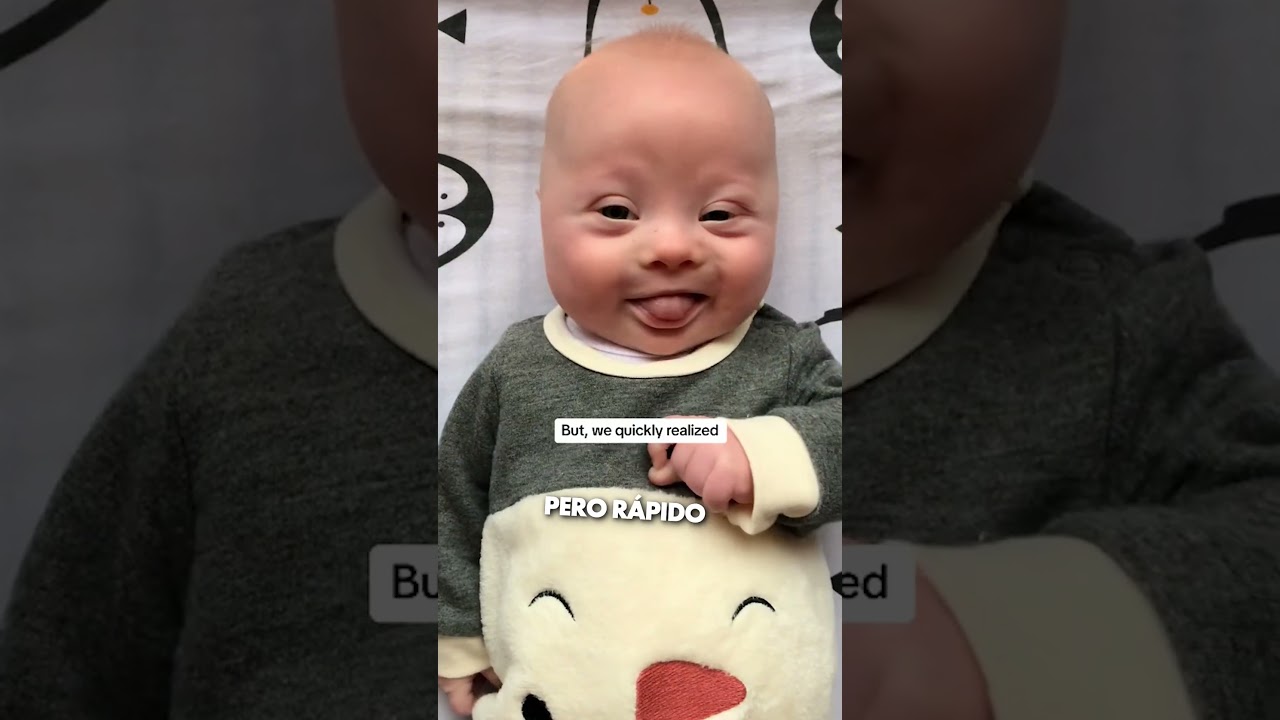 Este Bebé Down Es Una Bendición ❤️