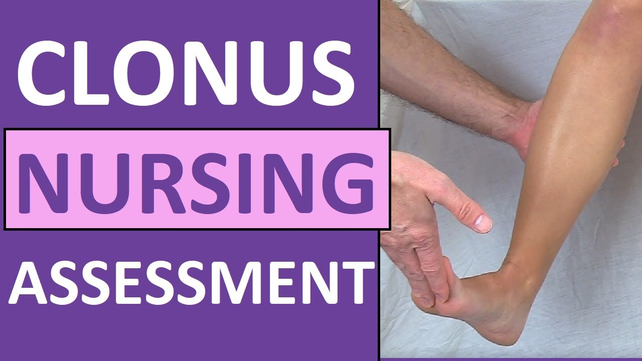 Clonus Test Positive Reflex Sign Preeclampsia Pregnancy - Nursing Skills