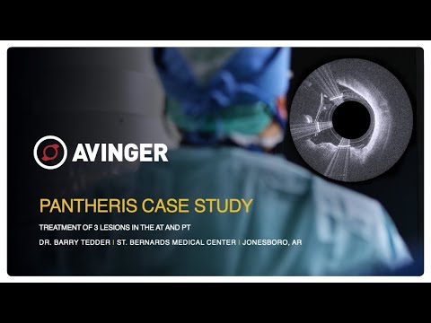 Pantheris SV 3 Lesions in the AT/PT case study by Dr  Barry Tedder of St. Bernards Medical Center
