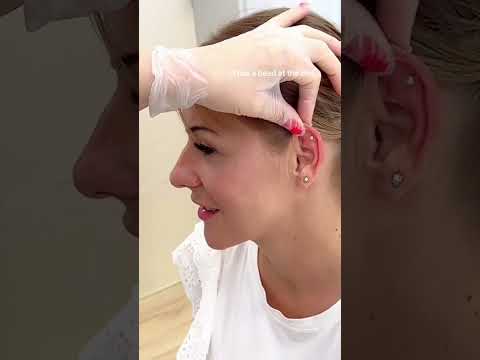 Gentle Helix Ear Piercing Using Barbell Ear Piercing| STUDEX® System75™