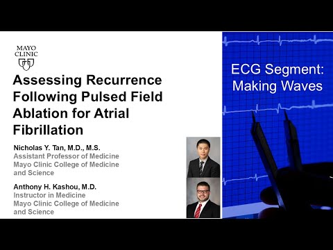 Assessing Recurrence Following Pulsed Field Ablation for ...