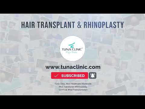 Tuna Clinic Hair Transplant