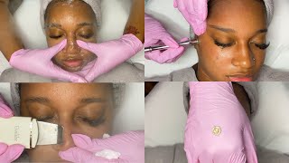 Download lagu Summer Glow Facial w Microdermabrasion GlamByLiaLe... mp3