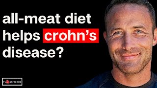 What Happens To Crohn's Disease On a Carnivore Diet?