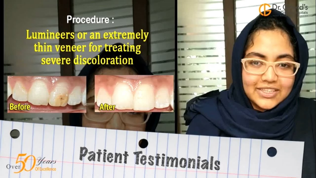 Lumineers or veneers for that Perfect Painless SMILE