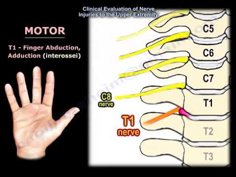 Neurological Evaluation of the Cervical Nerve Roots, Cervical Disc Herniation, Neck Pain.