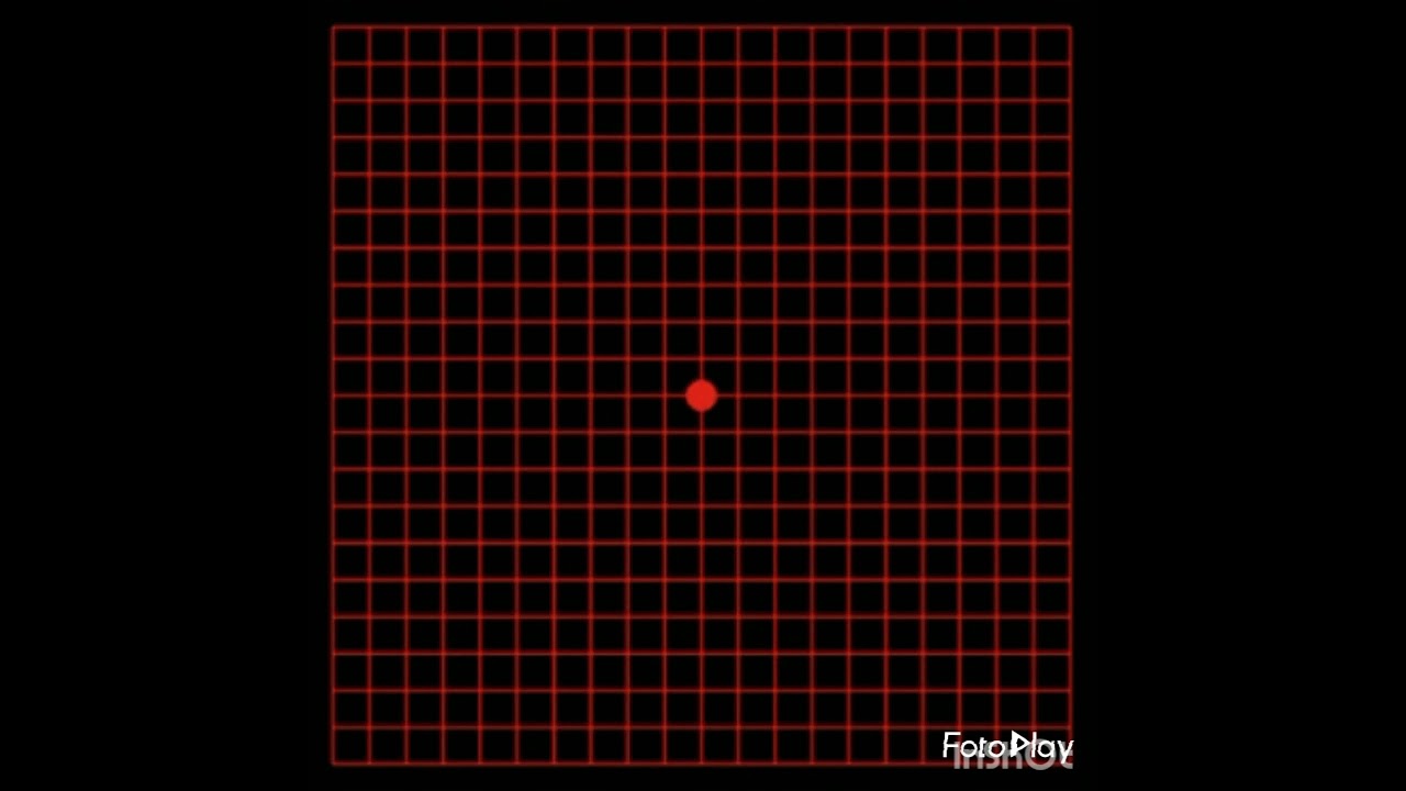 Para que sirve la rejilla de Amsler.