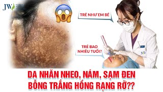 Quý bà U60 lộ bí quyết sở hữu LÀN DA EM BÉ nhờ liệu trình Multi+ Exosome ĐỘC QUYỀN JW
