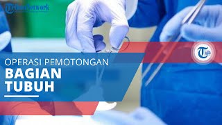 Amputasi, Operasi Pemotongan Bagian Tubuh yang Bertujuan Mengendalikan Rasa Sakit atau Penyakit
