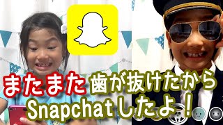 またまた歯が抜けたからスナップチャットでご報告