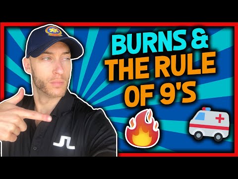 Burns & Rule of 9's Review for EMT's (Burn Patients in EMS)