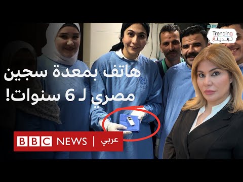 فيديو | استخراج هاتف محمول من معدة سجين مريض في مصر بعد 6 سنوات من ابتلاعه.. الطبيبة تتحدث عن طريقة استخراجه