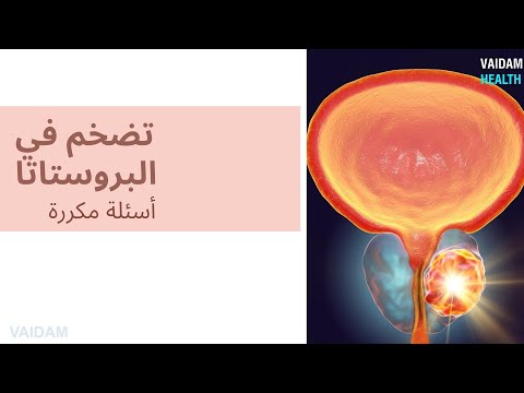 الأسئلة المتداولة حول تضخم البروستاتا