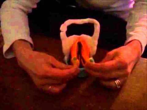 Thyroarytenoid Muscles of the Larynx by Melissa Largent