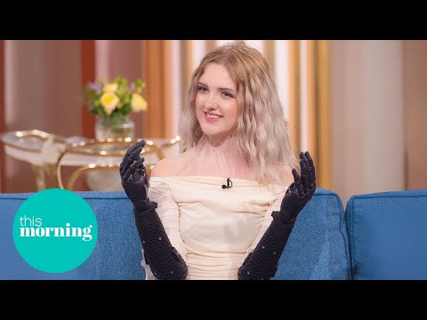 Teen With The World’s Most Advanced Bionic Hands