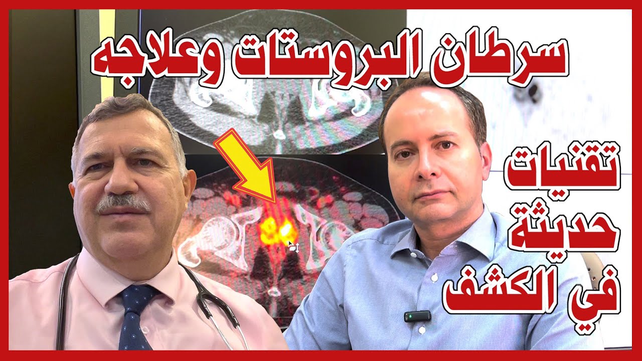 تقنيات حديثة في الكشف عن سرطان البروستات وعلاجه