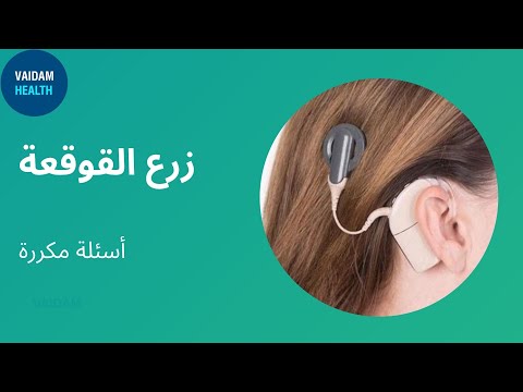 الأسئلة المتداولة حول زراعة القوقعة