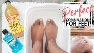 Listerine Foot Soak | Is It Effective? | Listerine And Vinegar Foot Soak | Listerine Foot Bath