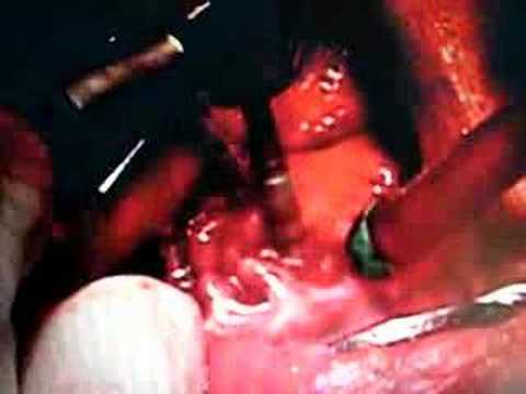 Dental implantation by Michel P. Jazzar