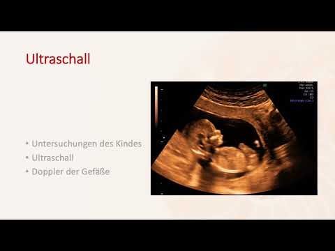 Schwangerschaftsbetreuung - Frauenarztpraxis Potsdamer Platz - Dr. Matthias Stroth & Natalia Egorova