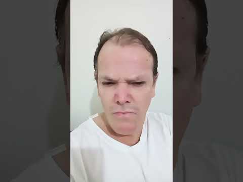 já virou Epidemia🤣🤔It has already become an epidemic🤔🤣