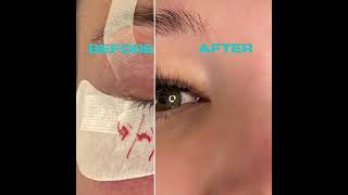 Before and After Lash Extensions 5D