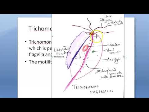 Trichomonas gyertyák nőknél