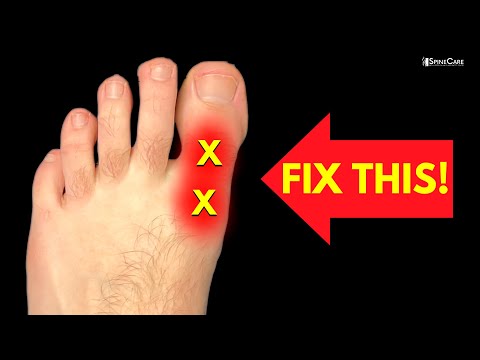 How to Fix BIG TOE Pain for Good