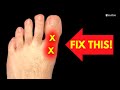 How To Fix BIG TOE Pain For Good