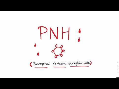 Paroxysmal Nocturnal Hemoglobinuria #PNH #Hematology #anaemia #paroxysmalnocturnalhemoglobinuria