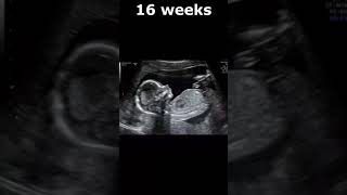 5-36 Weeks Embryo To Fetus Appearance On Ultrasound | Dr. Sam