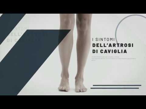 Piatti di titanio della colonna vertebrale toracica Diagnostica hip osteoporosi