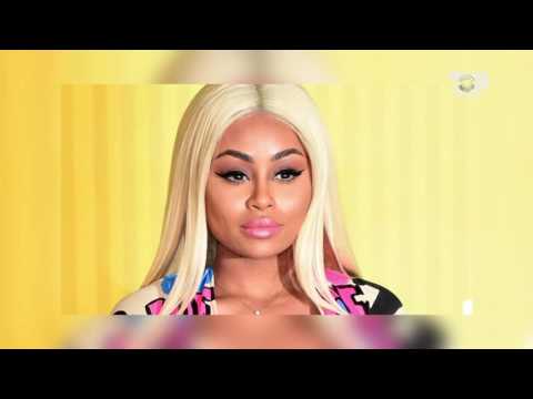 Select, 19 Dhjetor 2016, Pjesa 1 - Top Channel Albania - Entertainment Show